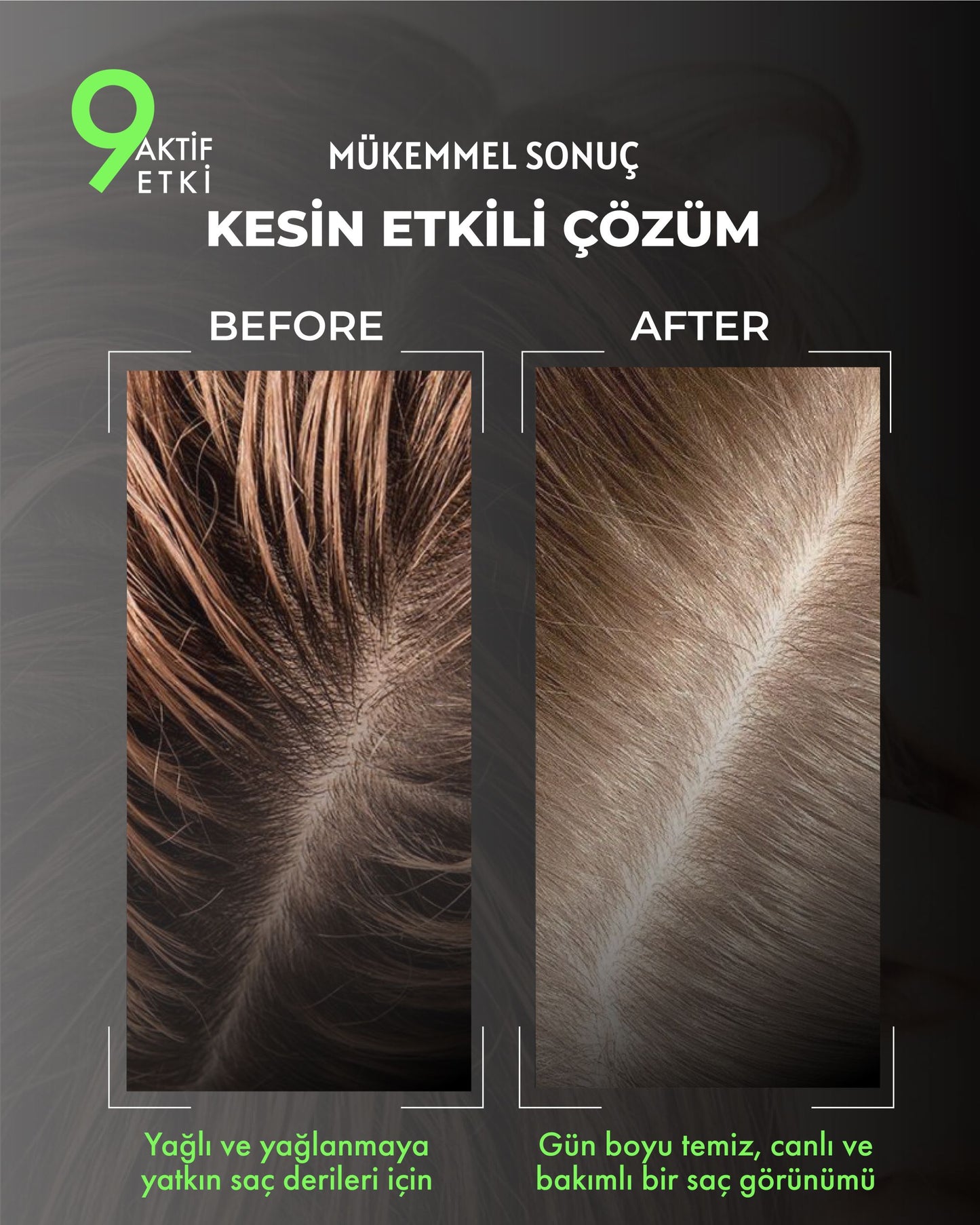 PURIVA | Yağlı Saçlar İçin Dengeleyici Saç Şampuanı